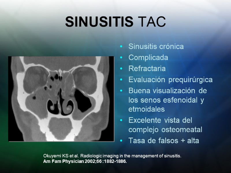 SINUSITIS TAC Sinusitis crónica Complicada Refractaria Evaluación prequirúrgica Buena visualización de los senos esfenoidal